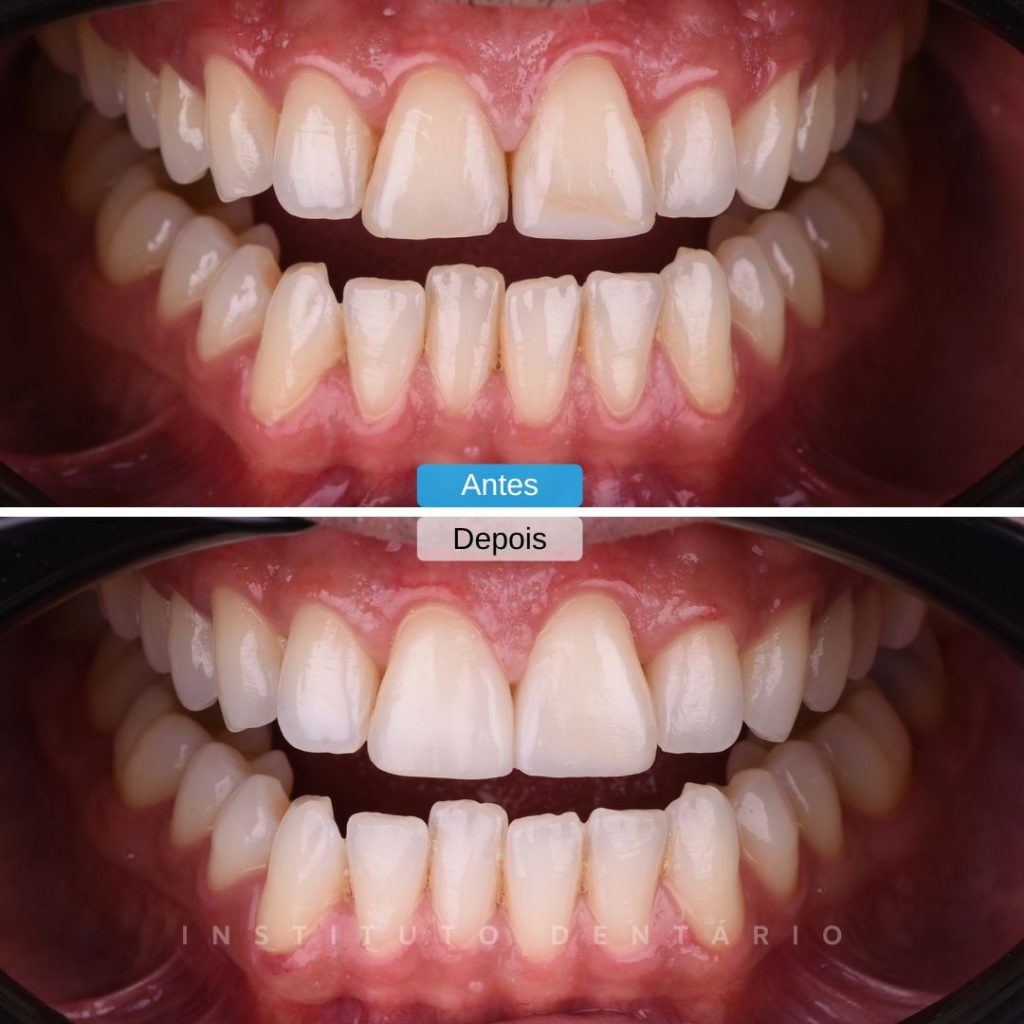 Dentisteria - Caso 2